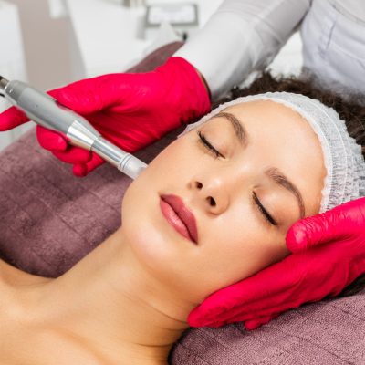 MICRONEEDLING
